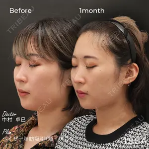 東京イセアクリニックの症例