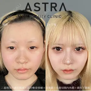 ASTRA BEAUTY CLINIC 塩満 惠子医師の症例