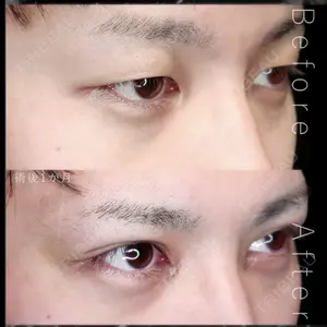 Tokyo Tensei Clinic 新宿院 辻 大成医師の症例