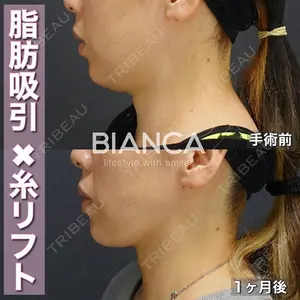 BIANCA表参道 大久保 由有医師の症例