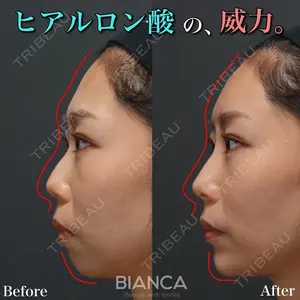 BIANCA銀座の症例
