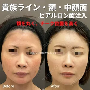 ロレシー美容クリニック 心斎橋駅前院 高田先生医師の症例