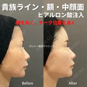 ロレシー美容クリニック 心斎橋駅前院 高田先生医師の症例