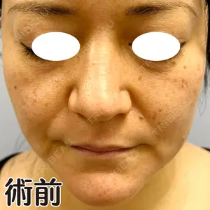 麹町皮ふ科・形成外科クリニックの症例