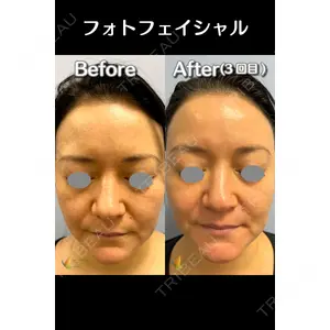 麹町皮ふ科・形成外科クリニックの症例