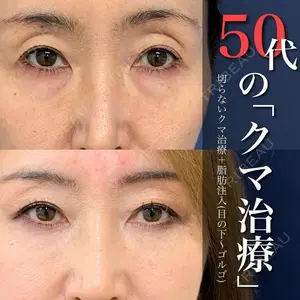 グローバルビューティークリニック 銀座院 理事長　杉崎　裕斗医師の症例