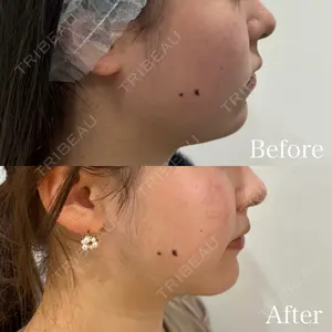 HAAB×DREAM BEAUTY CLINIC 東京本院 田中 優太医師の症例