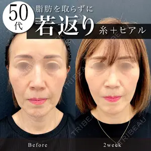 東京シンデレラ美容外科 池袋院の症例
