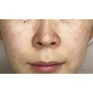 Original Beauty Clinic GINZA 佐藤玲史医師の症例