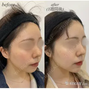 DMTC美容皮膚科 日本橋院 山中大介医師の症例