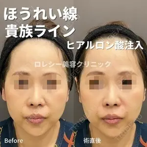 ロレシー美容クリニック 心斎橋駅前院 高田先生医師の症例