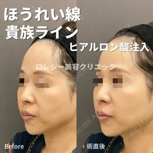 ロレシー美容クリニック 心斎橋駅前院 高田先生医師の症例