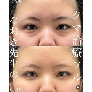 EMMO FACE CLINIC 大宮院 廣松 直樹医師の症例