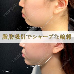 東京シンデレラ美容外科 池袋院の症例