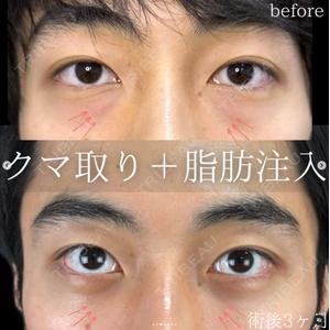 ルラ美容クリニック 仙台院 / ルラスキンクリニック 仙台院の症例