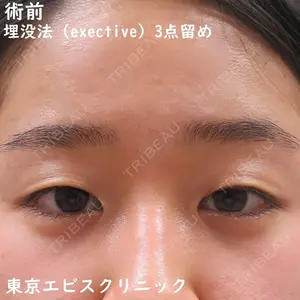 東京エビスクリニック 照屋 智医師の症例