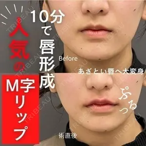 ロレシー美容クリニック 心斎橋駅前院 福留院長医師の症例