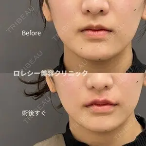 ロレシー美容クリニック 心斎橋駅前院 福留院長医師の症例