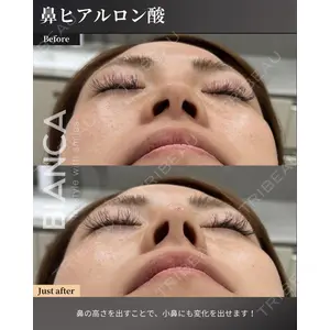 BIANCA銀座 服部 有美医師の症例