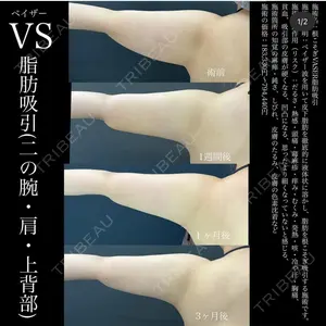 湘南美容クリニック 名古屋駅本院 豊嶋 沙良医師の症例