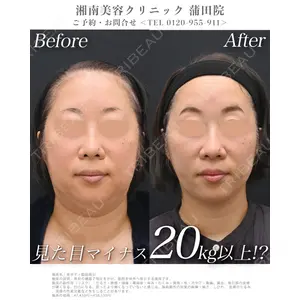 湘南美容クリニック 銀座院の症例