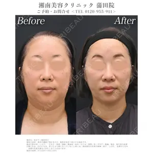 湘南美容クリニック 銀座院の症例
