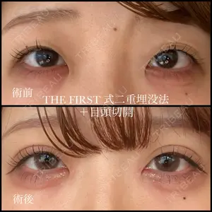 THE FIRST CLINIC 多摩センター院 惟村 公郁医師の症例