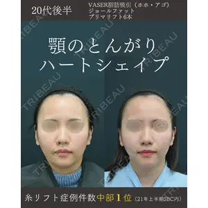 湘南美容クリニック 名古屋院 山本 高士医師の症例
