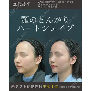 湘南美容クリニック 名古屋院 山本 高士医師の症例