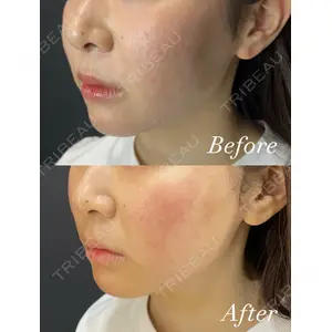 HAAB BEAUTY CLINIC 名古屋院 丸山 舜大医師の症例