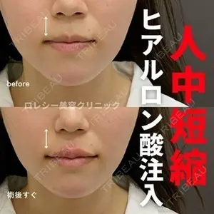 ロレシー美容クリニック 心斎橋駅前院 高田先生医師の症例