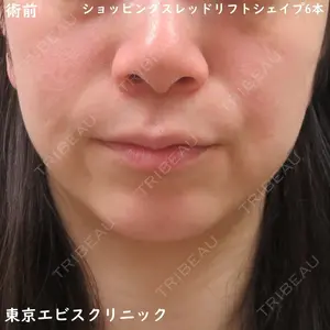 東京エビスクリニック 照屋 智医師の症例