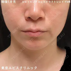 東京エビスクリニック 照屋 智医師の症例