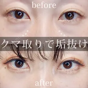 Tokyo Tensei Clinic 新宿院の症例