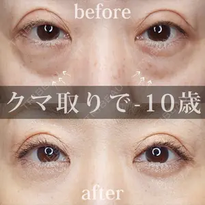 Tokyo Tensei Clinic 新宿院の症例