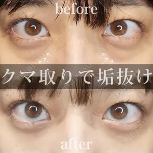 Tokyo Tensei Clinic 新宿院の症例