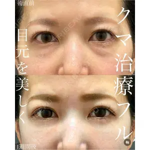 EMMO FACE CLINIC 大宮院 廣松 直樹医師の症例