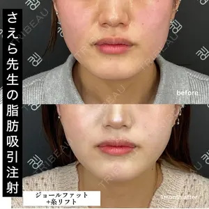 EMMO FACE CLINIC 大阪梅田院 山﨑 冴羅医師の症例