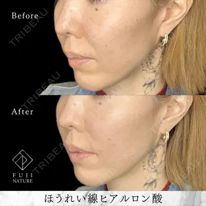 藤・ナチュレ美容クリニック 銀座院 小川 杏平医師の症例