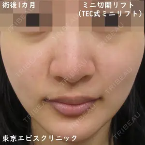 東京エビスクリニック 照屋 智医師の症例