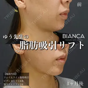 BIANCA表参道 大久保 由有医師の症例