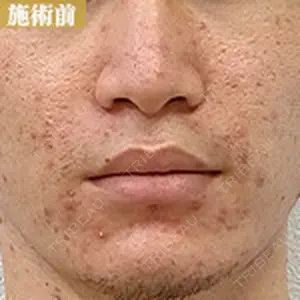 グランジョイクリニック 道上 育子医師の症例