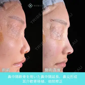 WOM CLINIC GINZA （ワム クリニック ギンザ） 中井 孝昌医師の症例