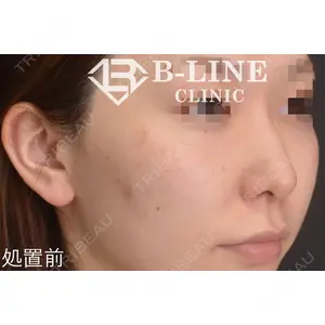 B-LINE CLINIC 池袋院 小池 康弘医師の症例