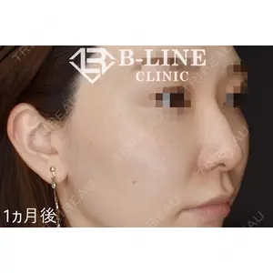 B-LINE CLINIC 池袋院 小池 康弘医師の症例