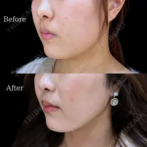 HAAB BEAUTY CLINIC 南青山本院（新院） 金子 雄医師の症例