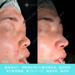 WOM CLINIC GINZA （ワム クリニック ギンザ） 中井 孝昌医師の症例