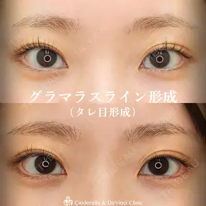 シンデレラ＆ダヴィンチクリニック 宮田 洋佑医師の症例