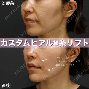 BIANCA表参道 大久保 由有医師の症例