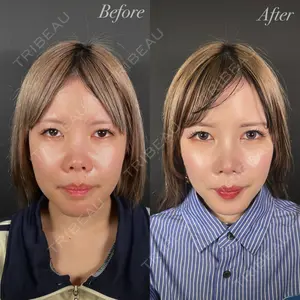 R Beauty CLINIC 大阪院 小池 泰弘医師の症例